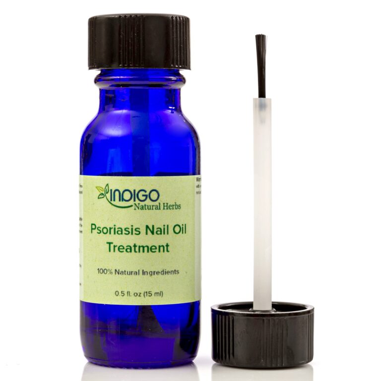 Cuidado natural: aceites esenciales para la psoriasis
