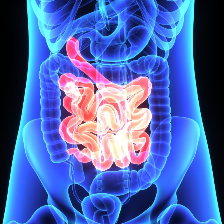 Problemas de salud en el delgado intestino